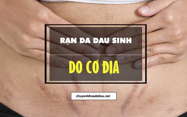 Nguyên nhân rạn da sau sinh do cơ địa