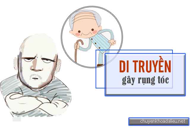 Rụng tóc do di truyền