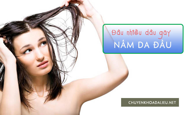 Triệu chứng bệnh nấm da đầu