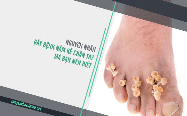 nguyên nhân bị nấm kẽ chân tay