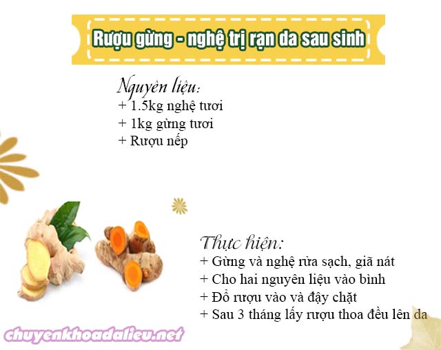 trị rạn da sau khi sinh bằng rượu nghệ gừng