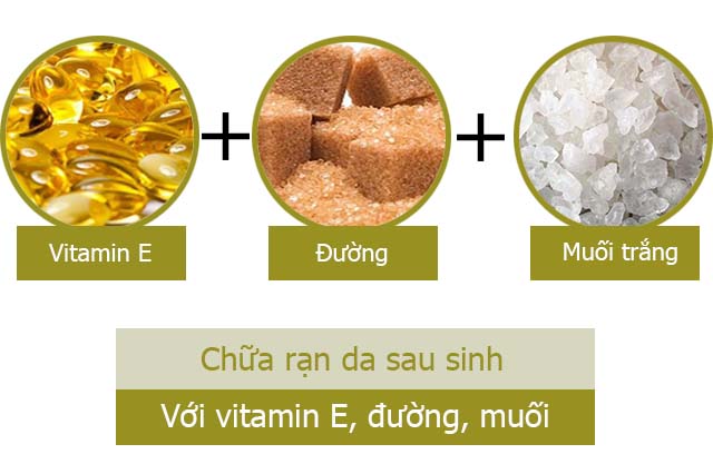 Cách làm mờ vết rạn da sau sinh bằng vitamin E, đường và muối