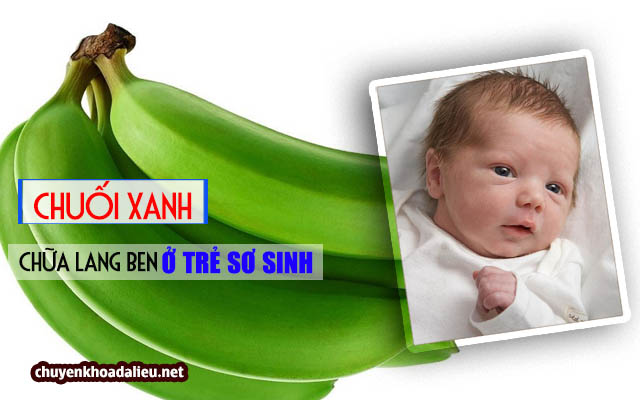  chữa lang ben ở trẻ sơ sinh bằng chuối xanh 