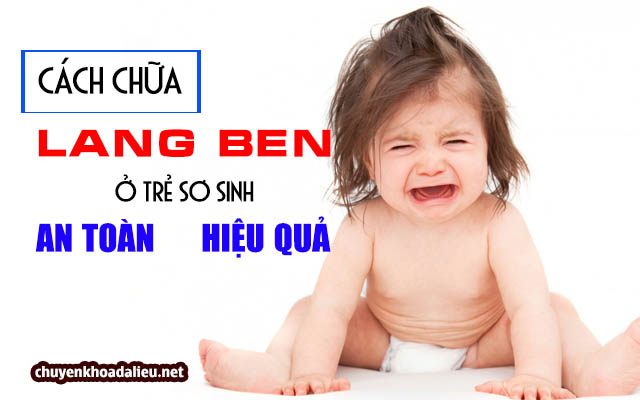 cách chữa lang ben ở trẻ sơ sinh