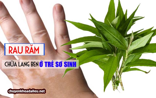 rau răm trị lang ben ở trẻ sơ sinh 