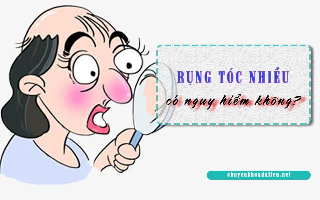 Rụng tóc nhiều