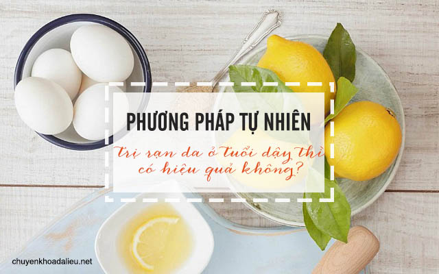 Cách trị rạn da ở tuổi dậy thì