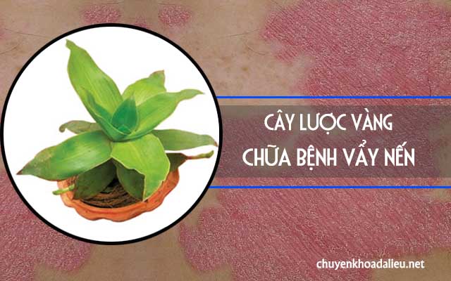 Chữa vẩy nến bằng cây lược vàng