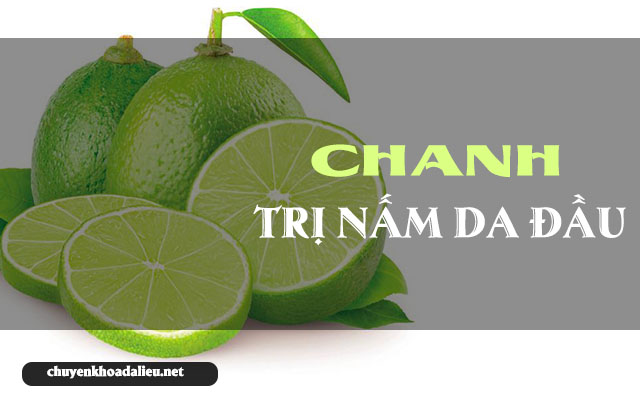 tác dụng trị nấm da đầu hiệu quả của chanh