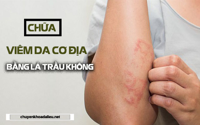 Chữa viêm da cơ địa bằng lá trầu không