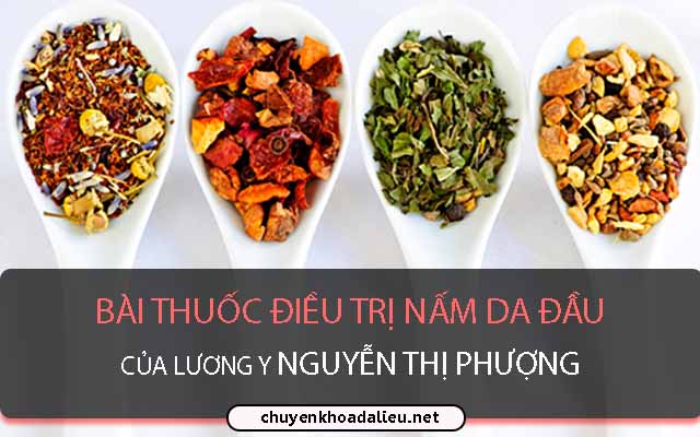 Bài thuốc điều trị nấm da đầu của lương y Nguyễn Thị Phượng