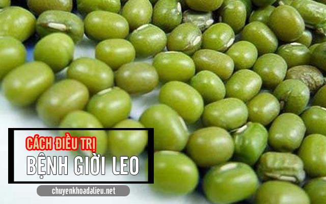 điều trị bệnh giời leo
