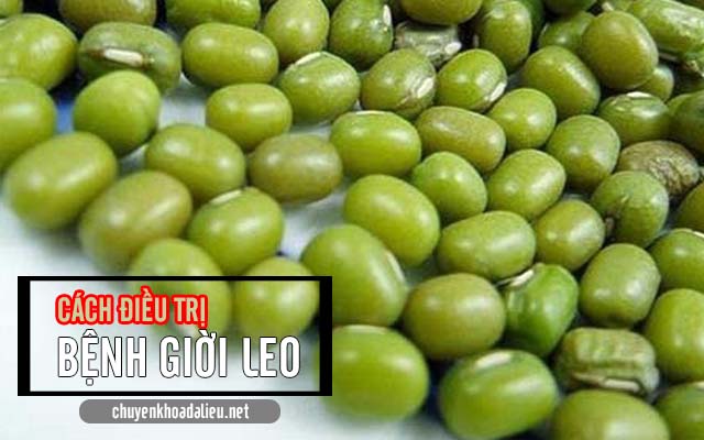 điều trị bệnh giời leo