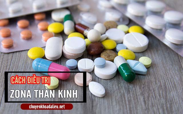 Điều trị bệnh zona thần kinh