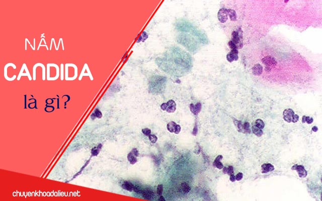 Nấm candida là gì