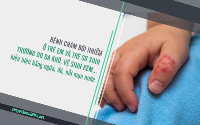 nguyên nhân gây chàm bội nhiễm ở trẻ em