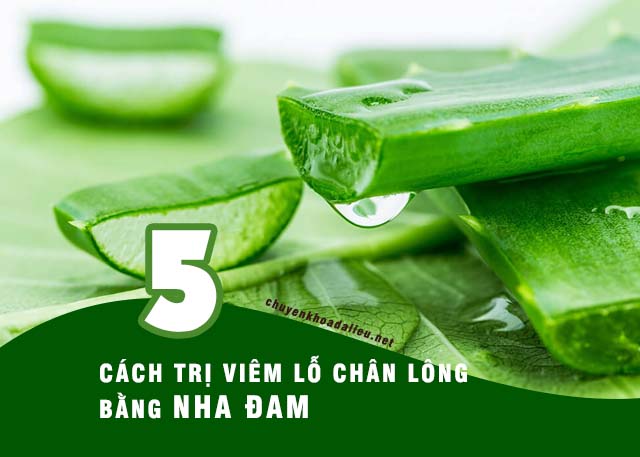 những cách chữa viêm lỗ chân lông bằng nha đam