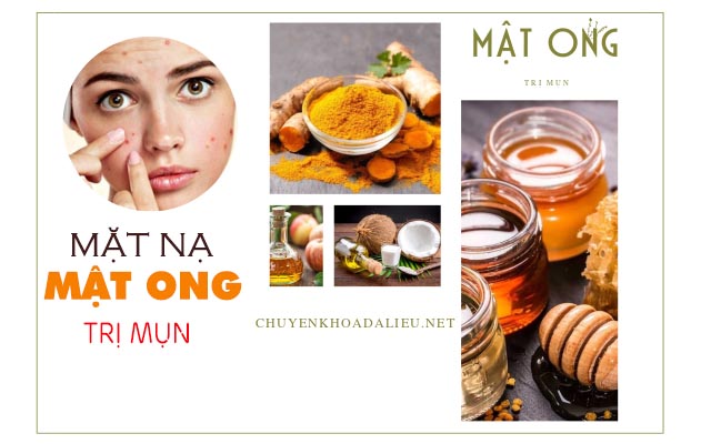 cách làm mặt nạ mật ong trị mụn