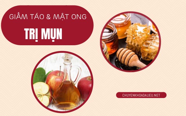 mật ong trị mụn trứng cá