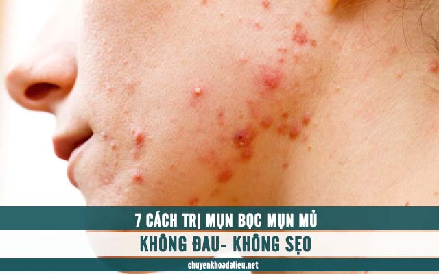 cách trị mụn bọc mụn mủ