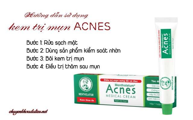 Cách sử dụng kem trị mụn Acnes