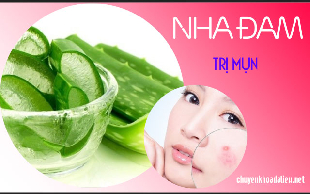 cách dùng nha đam trị mụn