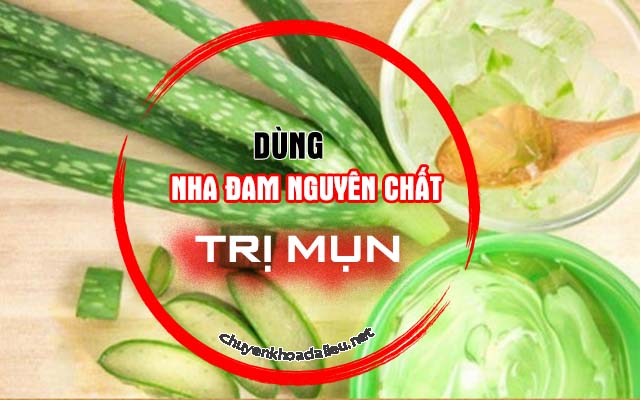 trị mụn bằng nha đam