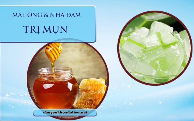 Trị mụn bằng nha đam mật ong