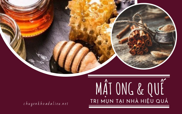 cách trị mụn trứng cá hiệu quả