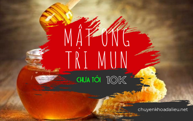 cách trị mụn trứng cá hiệu quả nhất tại nhà