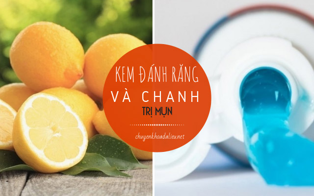 trị mụn bằng kem đánh răng2