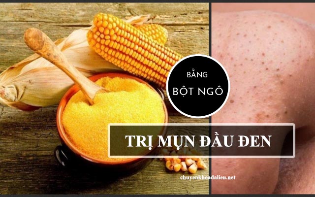 Cách trị mụn đầu đen tại nhà với bột ngô