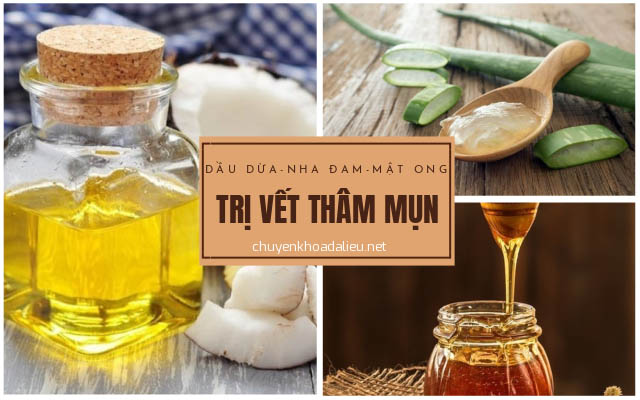 Cách trị vết thâm bằng dầu dừa