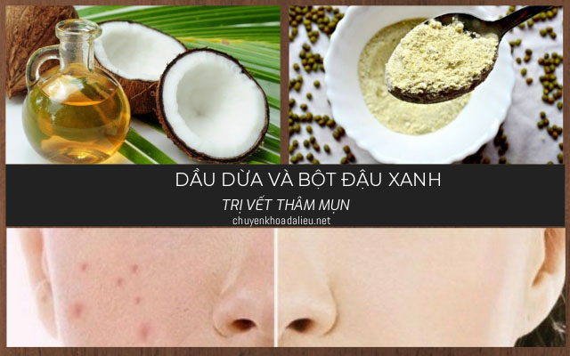 trị vết thâm mụn bằng dầu dừa và bột đậu xanh