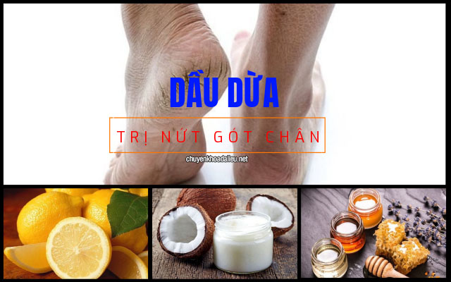 trị nứt gót chân bằng dầu dừa