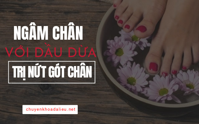 trị nứt gót chân bằng cách ngâm chân với dầu dừa