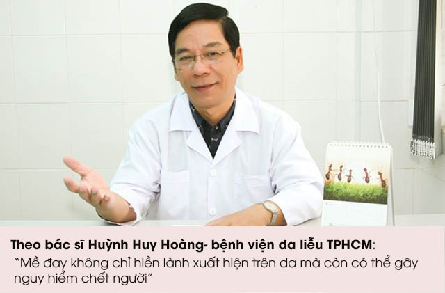 Bác sĩ Huỳnh Huy Hoàng tư vấn về bệnh mề đay