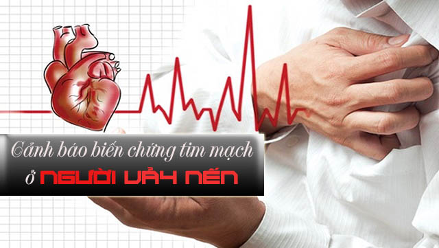 Biến chứng tim mạch ở bệnh nhân bị vẩy nến