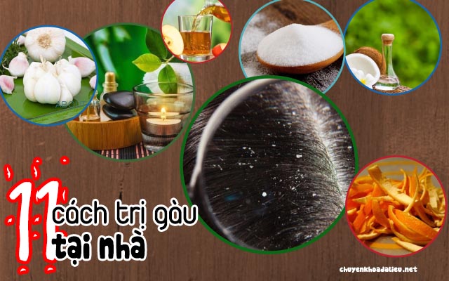 cách trị gàu tại nhà