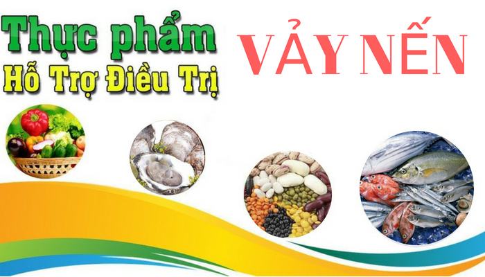 Thực phẩm ngừa bị vẩy nến nên ăn