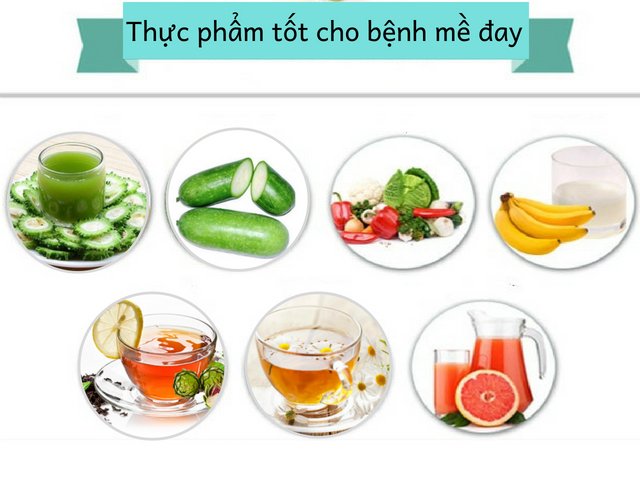 Thực phẩm người bị nổi mề đay ngứa nên ăn