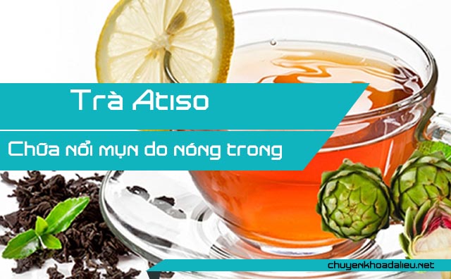 Chữa mụn do nóng trong bằng trà Atiso