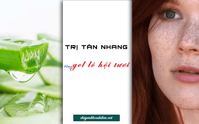 Trị tàn nhang bằng gel lô hội