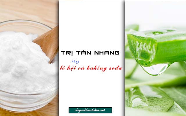 Trị tàn nhang bằng lô hội và baking soda