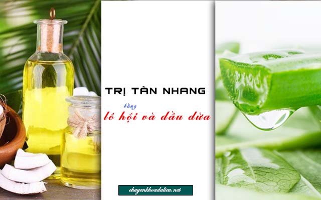 Chữa nha đam bằng lô hội và dầu dừa