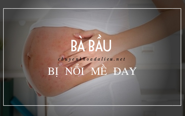 bà bầu bị nổi mề đay