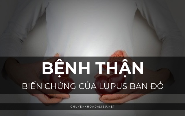 biến chứng của lupus ban đỏ2