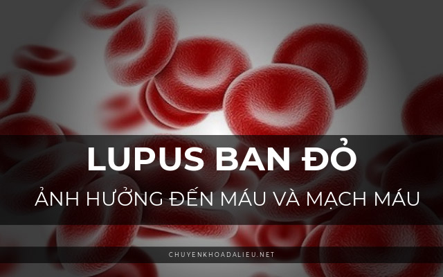 biến chứng của lupus ban đỏ3