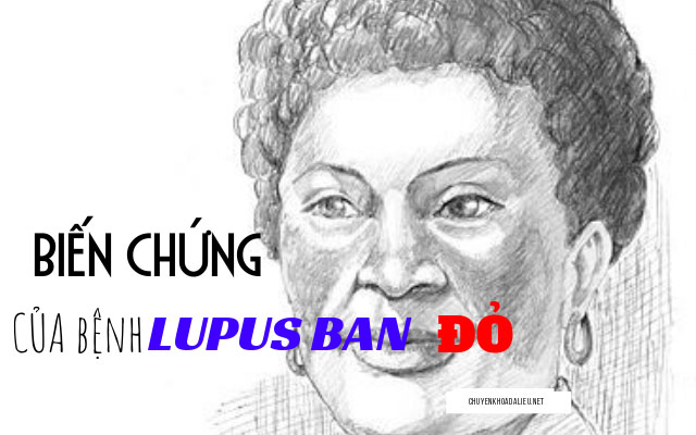 biến chứng của lupus ban đỏ