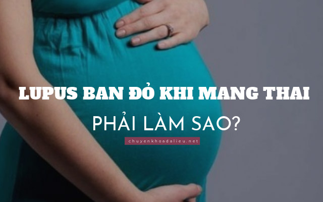 phải làm sao khi bị lupus ban đỏ khi mang thai